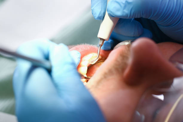 Best Tooth Pain Emergency Relief  in District Heights, MD