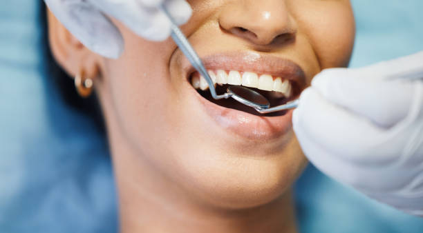 Best Root Canal Emergency Dentist  in District Heights, MD