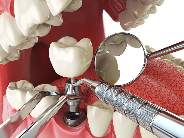 Best Emergency Tooth Extraction  in District Heights, MD